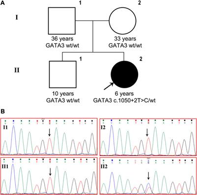 A GATA3 gene mutation that causes incorrect splicing and HDR syndrome: a case study and literature review